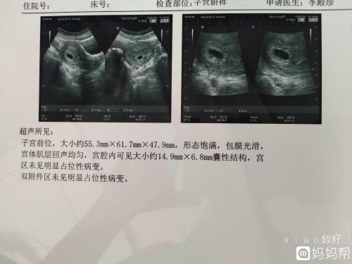 香港验血怀孕周期