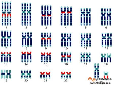 香港无创可以检查23对染色体吗